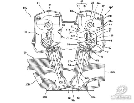 VVT